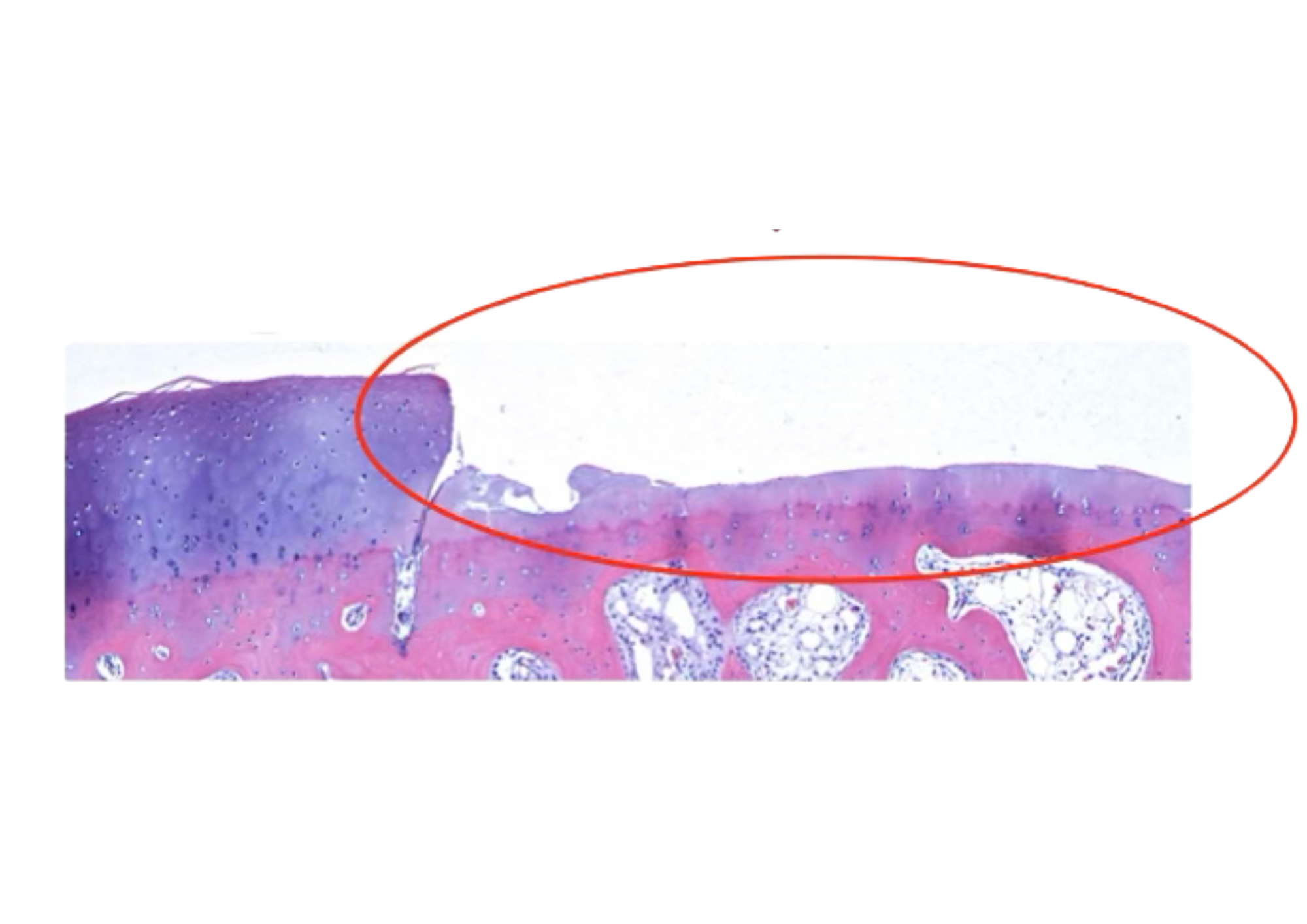 Tissue slide of a healthy joint with a plump, restored cartilage cushion