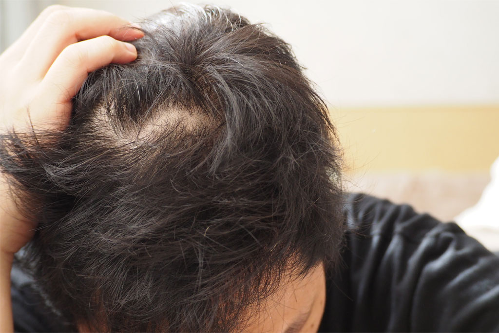 Your Guide to Thicker, Healthier Hair