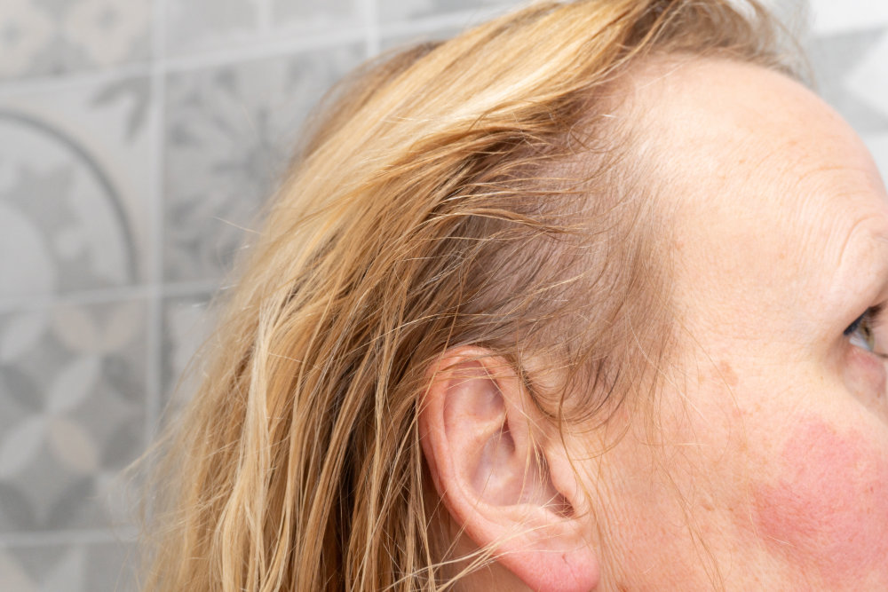 What Are Exosomes and Why Are They Changing Hair Restoration?