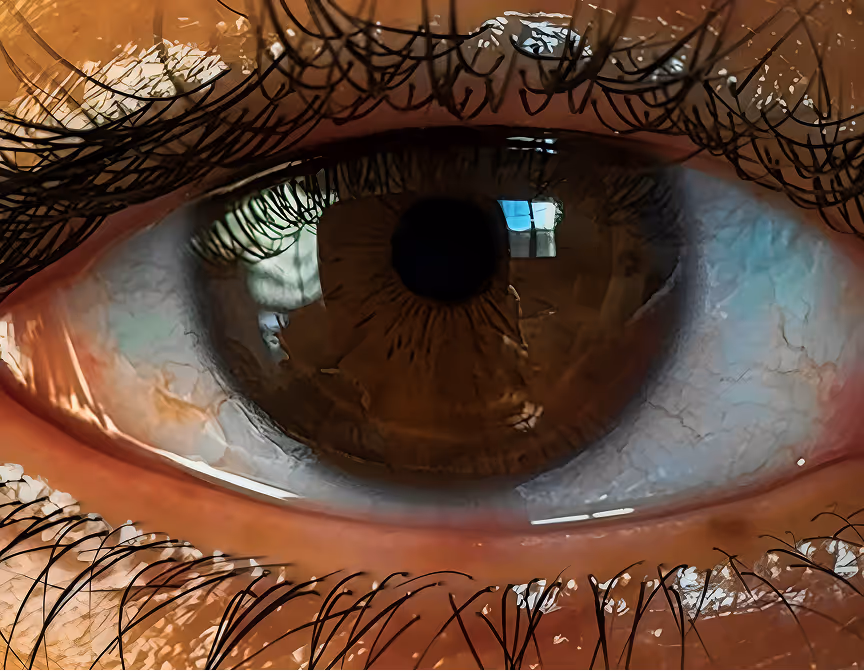 Close-up of a brown eye showing detailed eyelashes and reflections on the cornea.