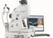 Optical coherence tomography (OCT) machine with a monitor showing retinal scan images.