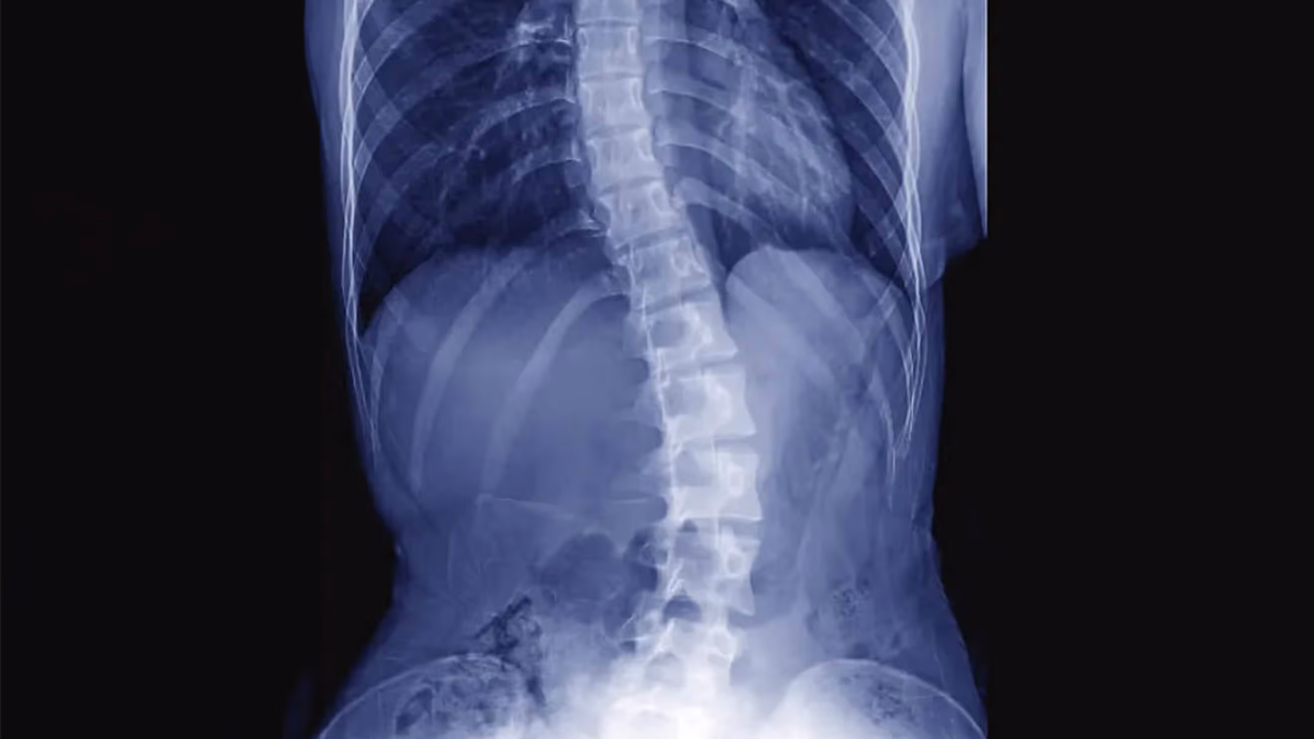 Chiropractic treatment room at Thrive Wellness Center Fayetteville Arkansas