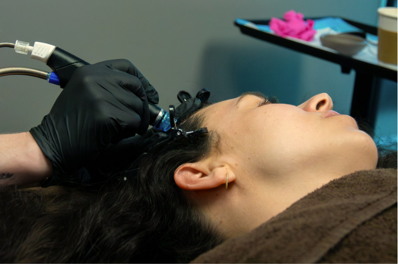 Scalp Treatment Right for You with Kairos 