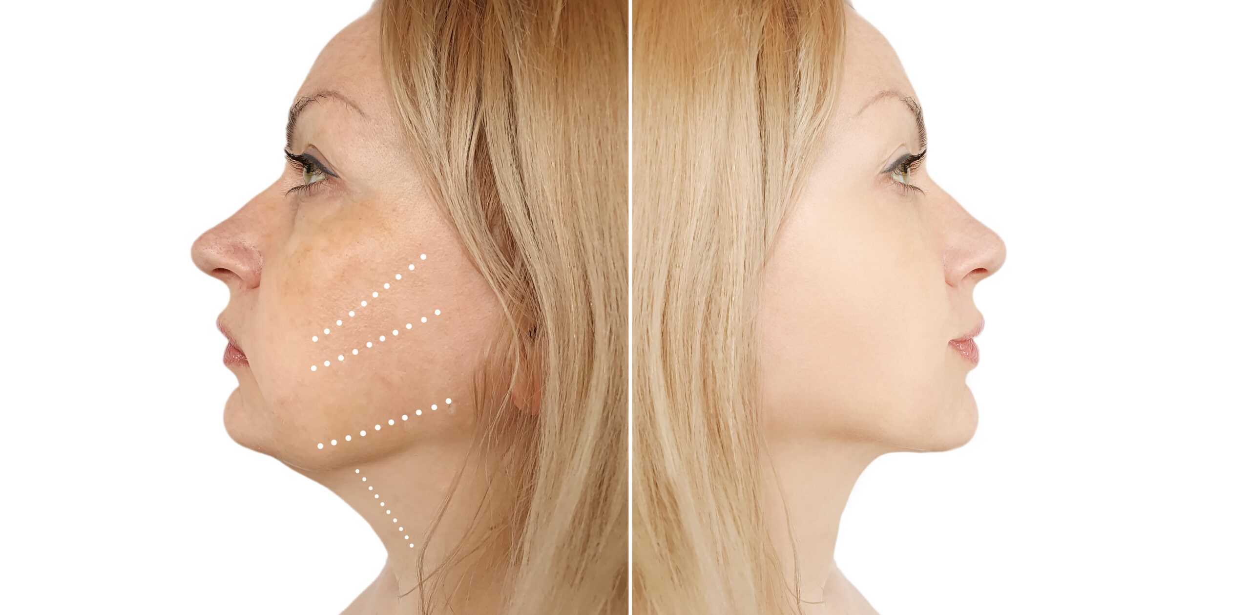 image of a community gathering