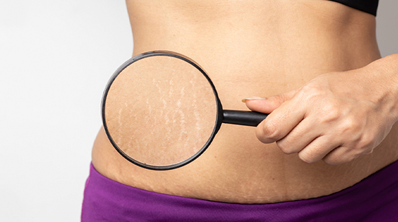 image of a community gathering