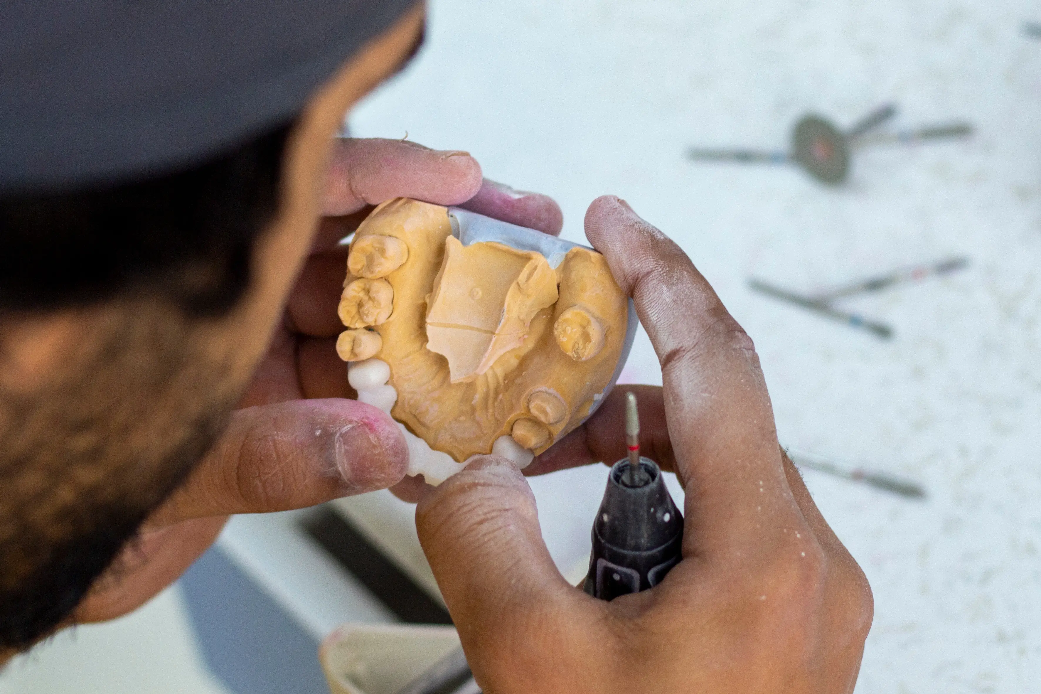 Full Mouth Reconstruction