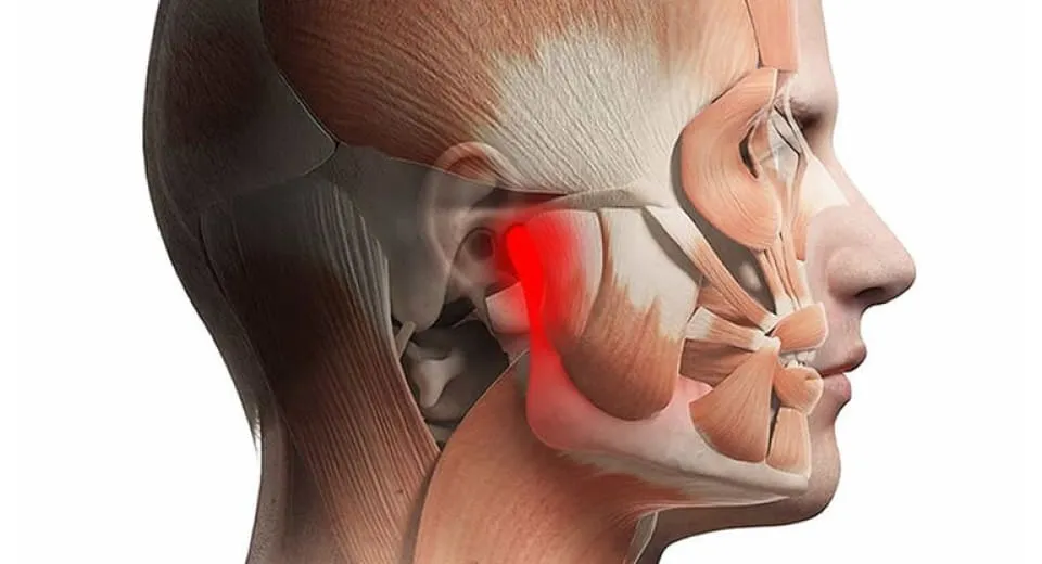 Medical illustration of the head's muscular and skeletal structure highlighting the temporomandibular joint area in red.