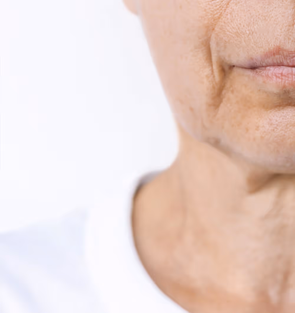 Close-up of an older person's lower face and neck showing wrinkles and textured skin.
