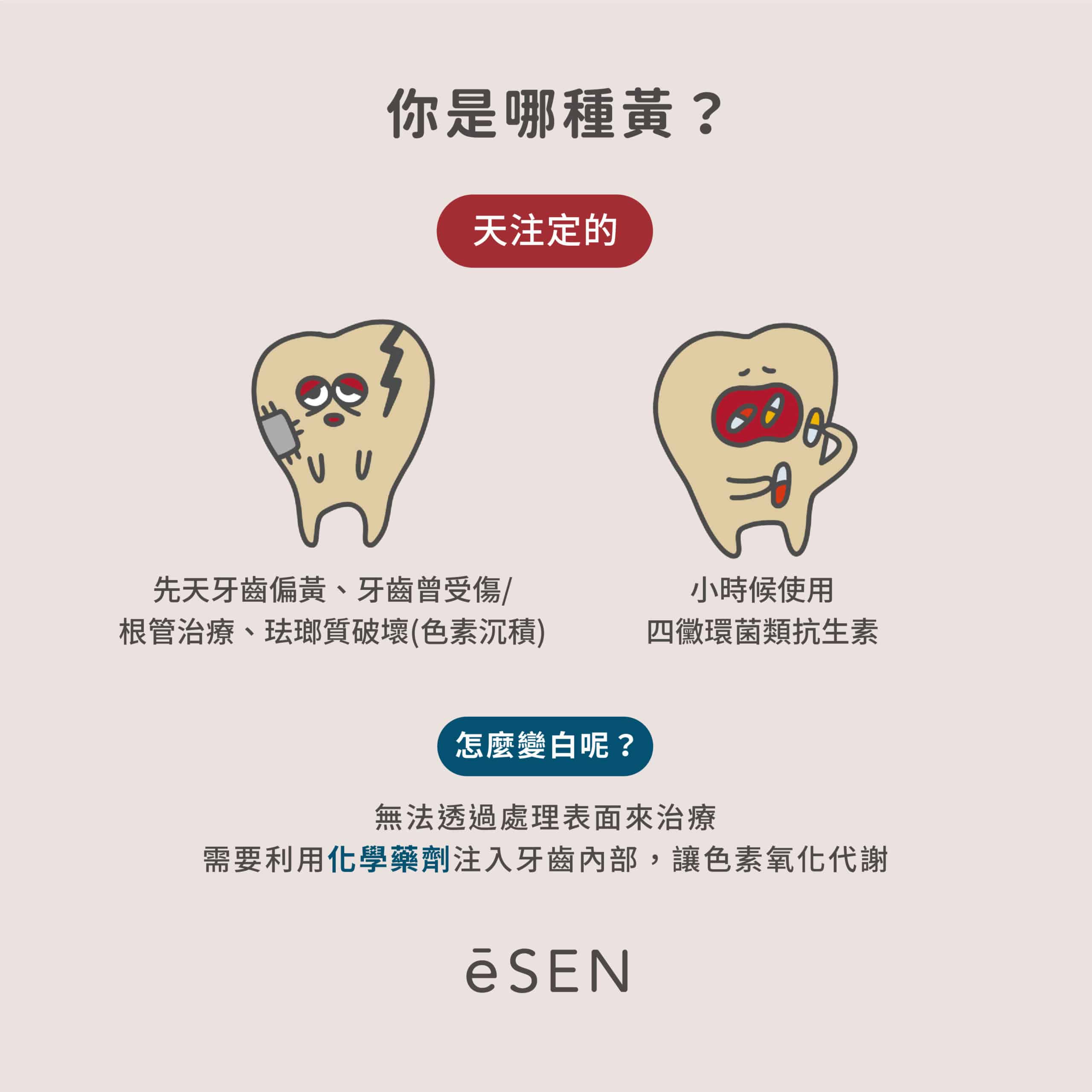 還我閃亮白牙齒!冷光美白、陶瓷貼片_03