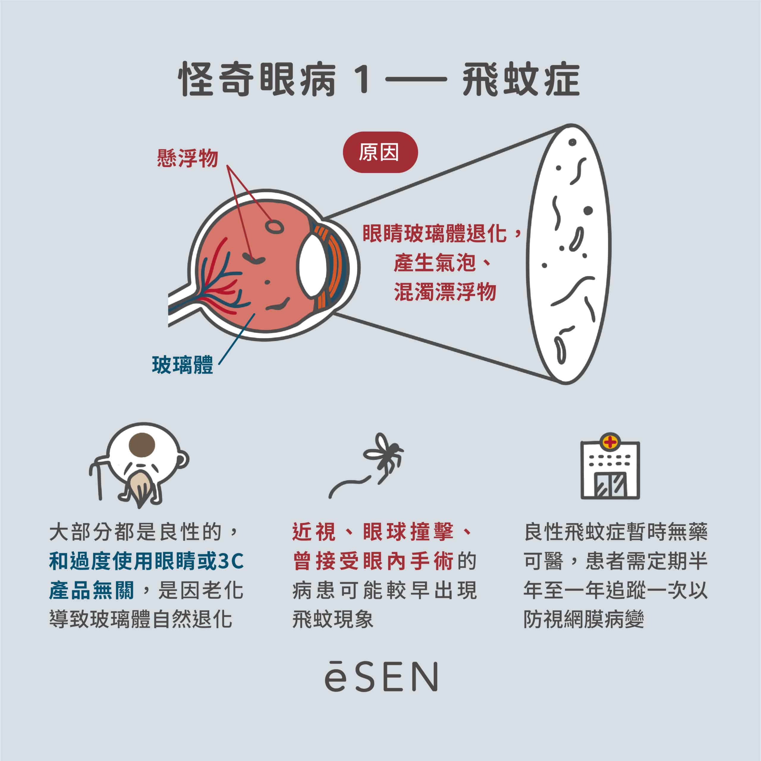 乾眼、飛蚊、美瞳!小心眼睛的必死技!_02