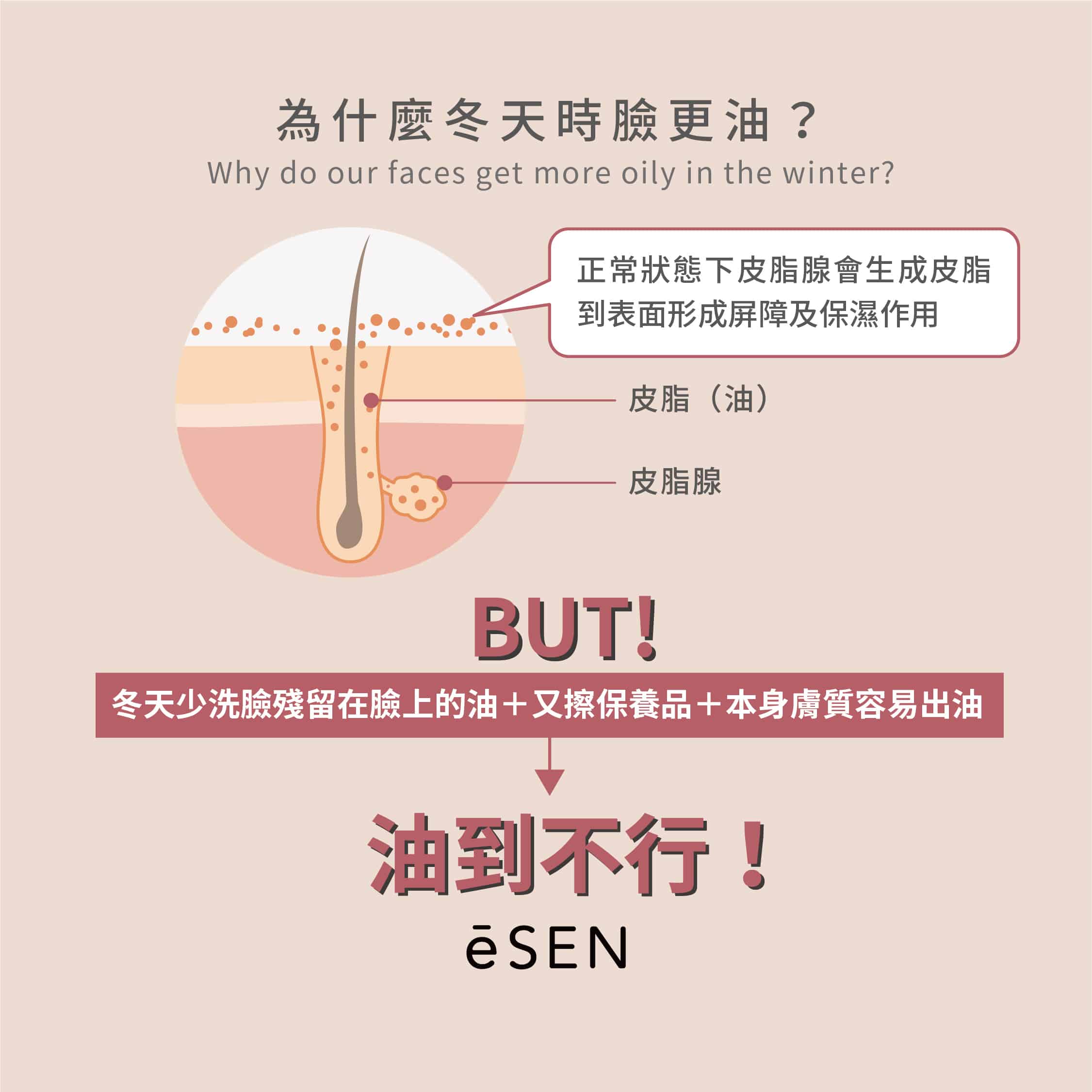 冬天臉更容易出油嗎?_04