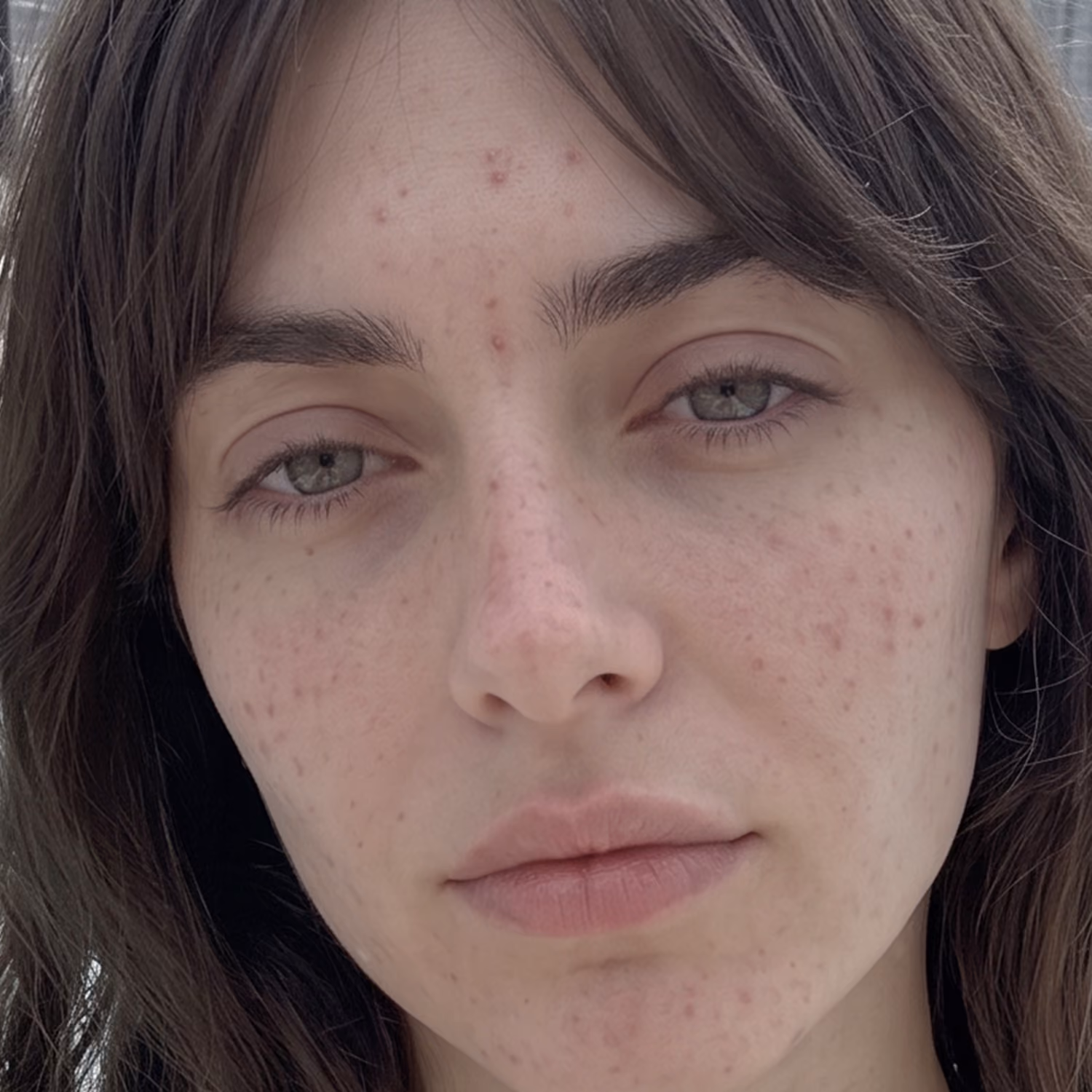 Fine lines · before