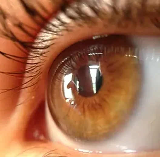 Close-up of a brown eye with detailed iris and eyelashes visible.