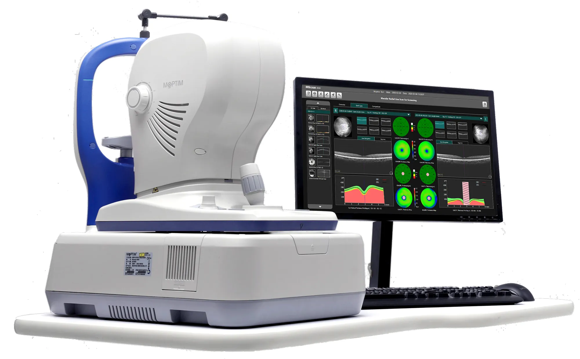 MOPTIM eye scanning device connected to a computer monitor displaying macular radial line scan data and thickness maps.