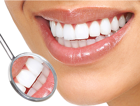 Teeth Cleaning | Dentist North Ryde | North Ryde Dentistry
