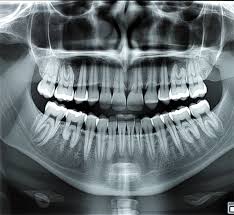 Dental X-ray Interpretation Online - CT Read