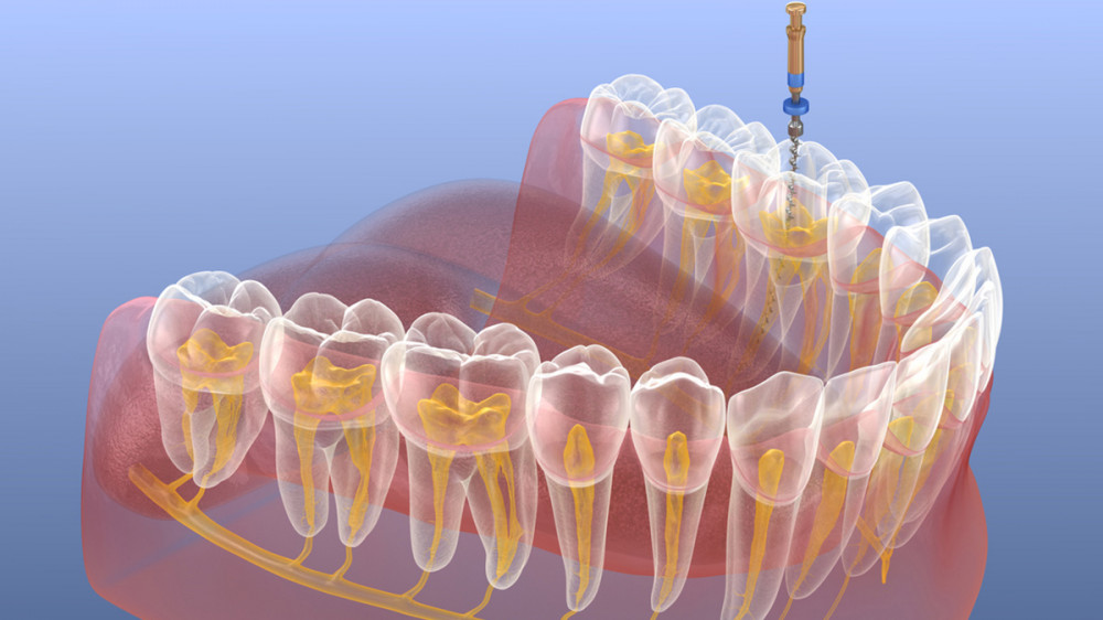 Division of Endodontics | College of Dentistry