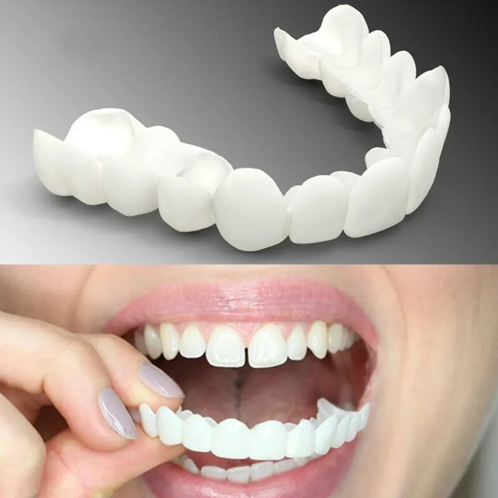 How Much Is A Full Set Of Veneers​?
