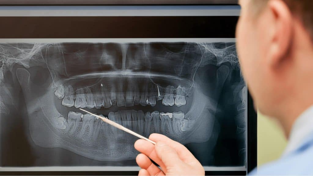 Dental X-Rays Demystified: Types, Importance, and Safety