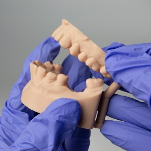 Hands wearing blue gloves holding dental jawbone models with teeth.