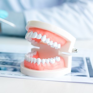 Dental model of upper and lower teeth on a desk with a blurred background.