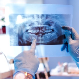 Gloved hands holding and pointing at a dental X-ray showing teeth and jaw structure.