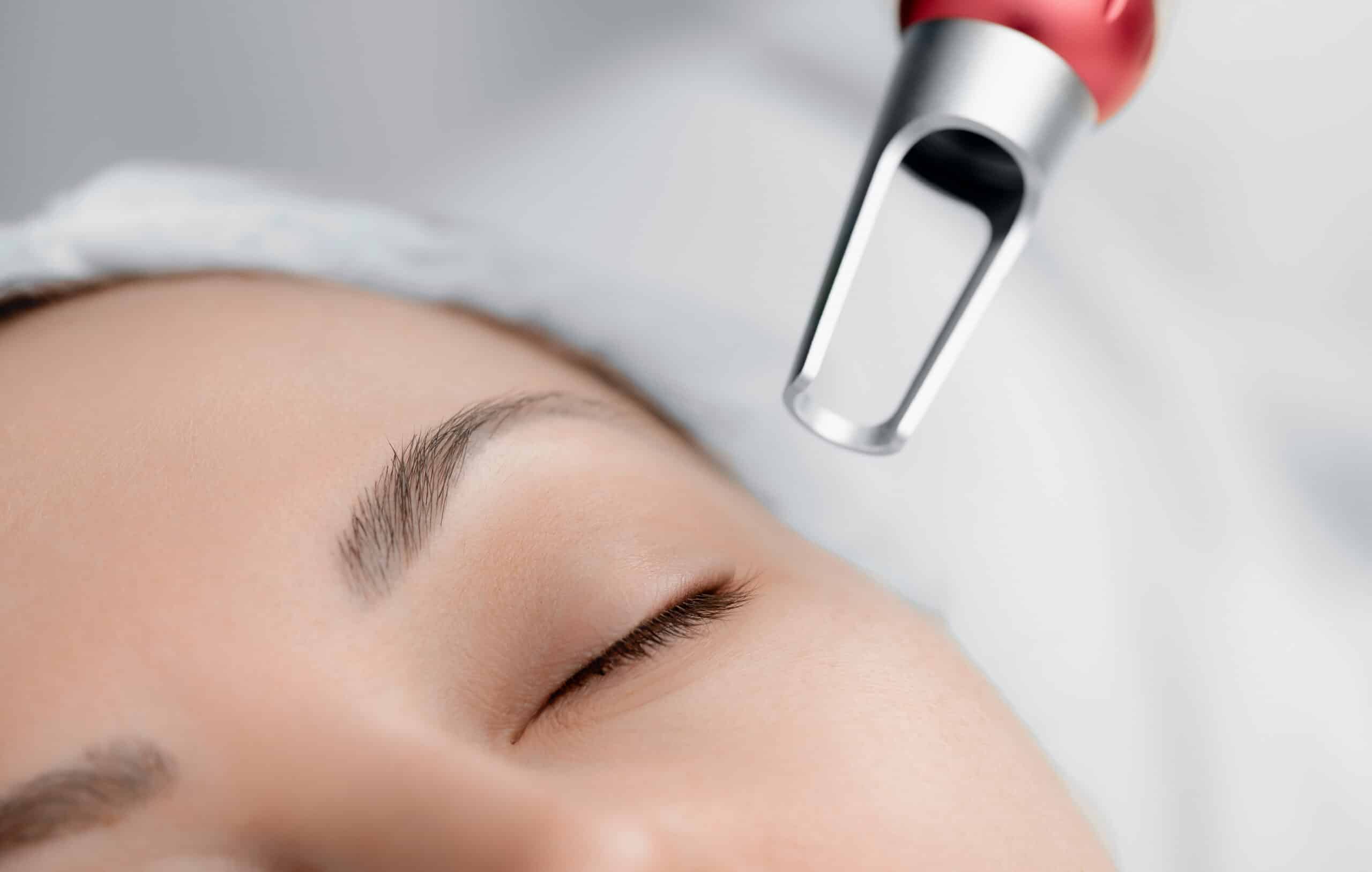 5 Surprising Benefits Of Pico Laser You May Not Know - SL Aesthetic Clinic