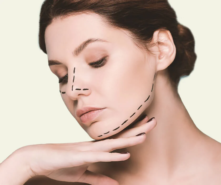 Zygoma Reduction Plasty in Surat | Elegance Clinic