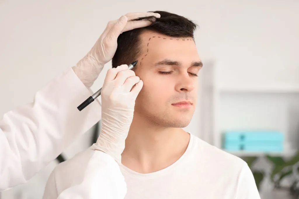 How Does Hair Transplant Work? | NE Hair