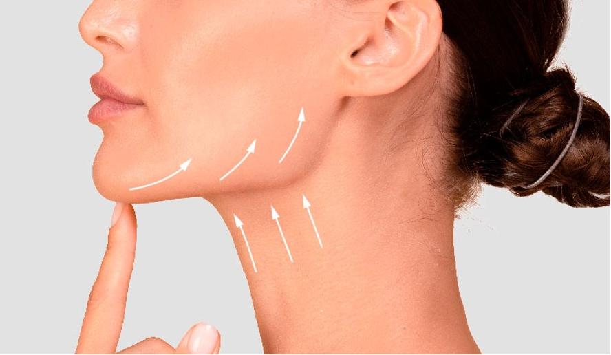 Neck and Jawline Botulinum Toxin (Nerfertiti Lift) - Bay Aesthetics Clinic  and Medispa
