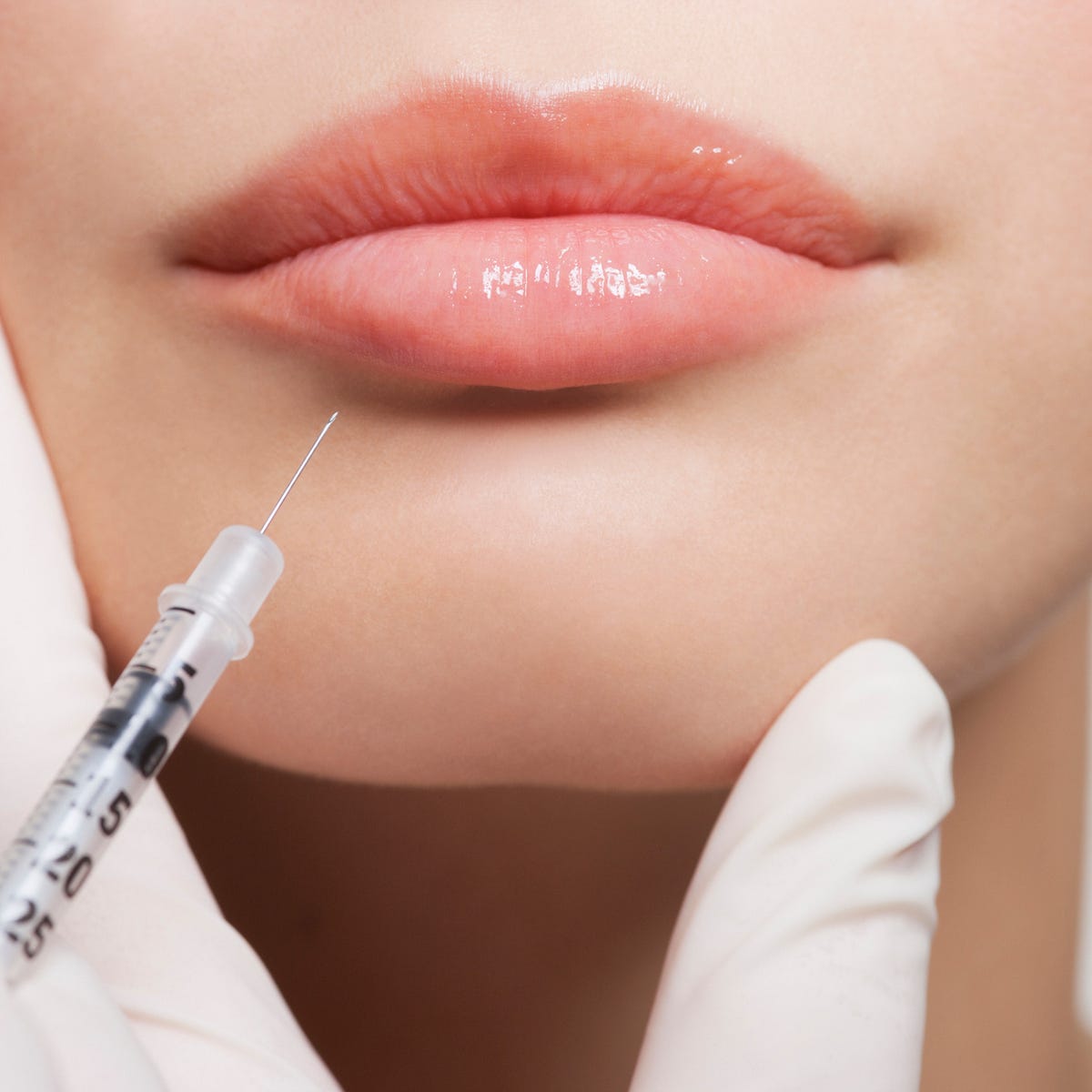9 Things To Know Before Getting Lip Injections, Per Experts