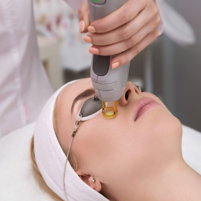 Fractional CO2 Laser Treatment - Ang Skin & Hair Clinic