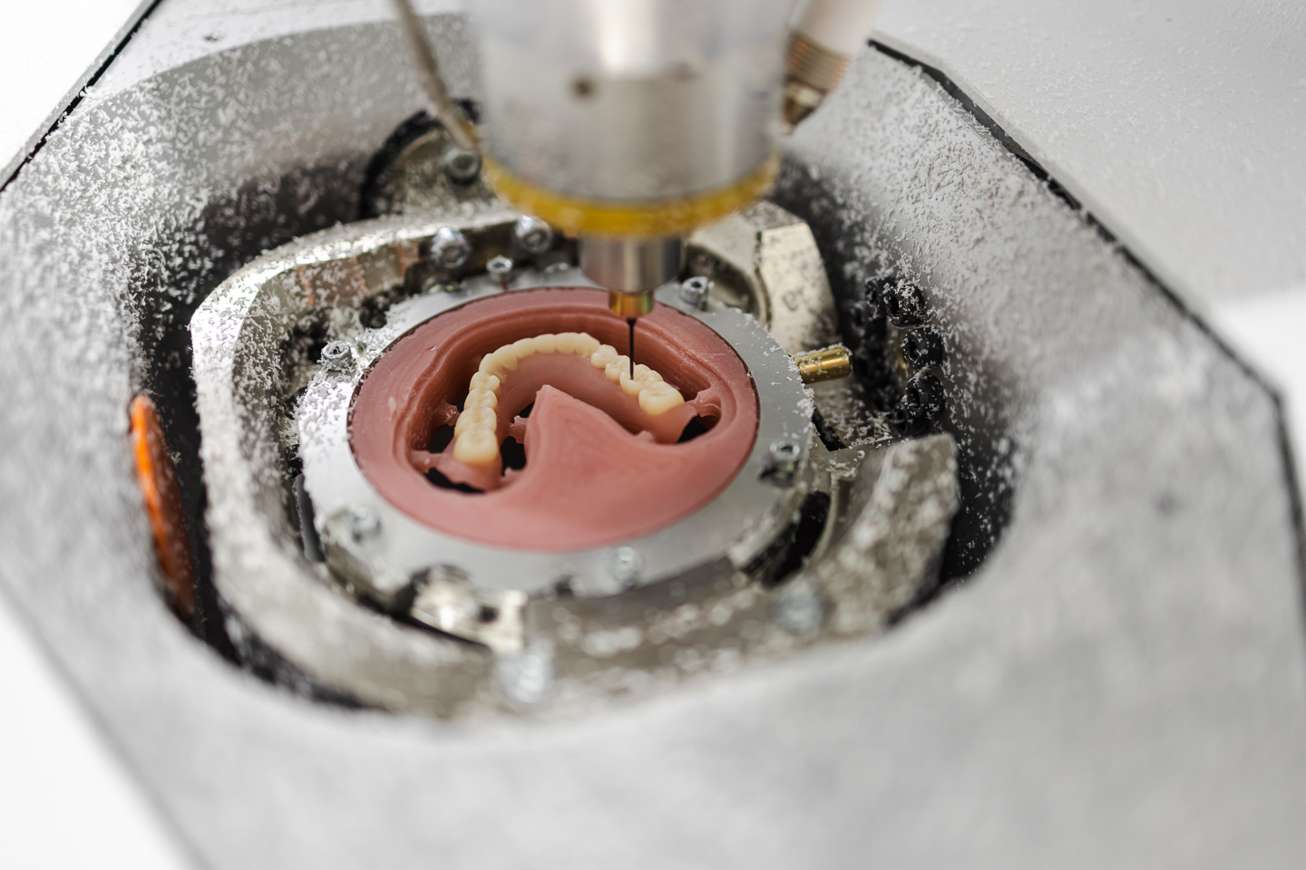 Zahnlabor-Erstellung -Prothese