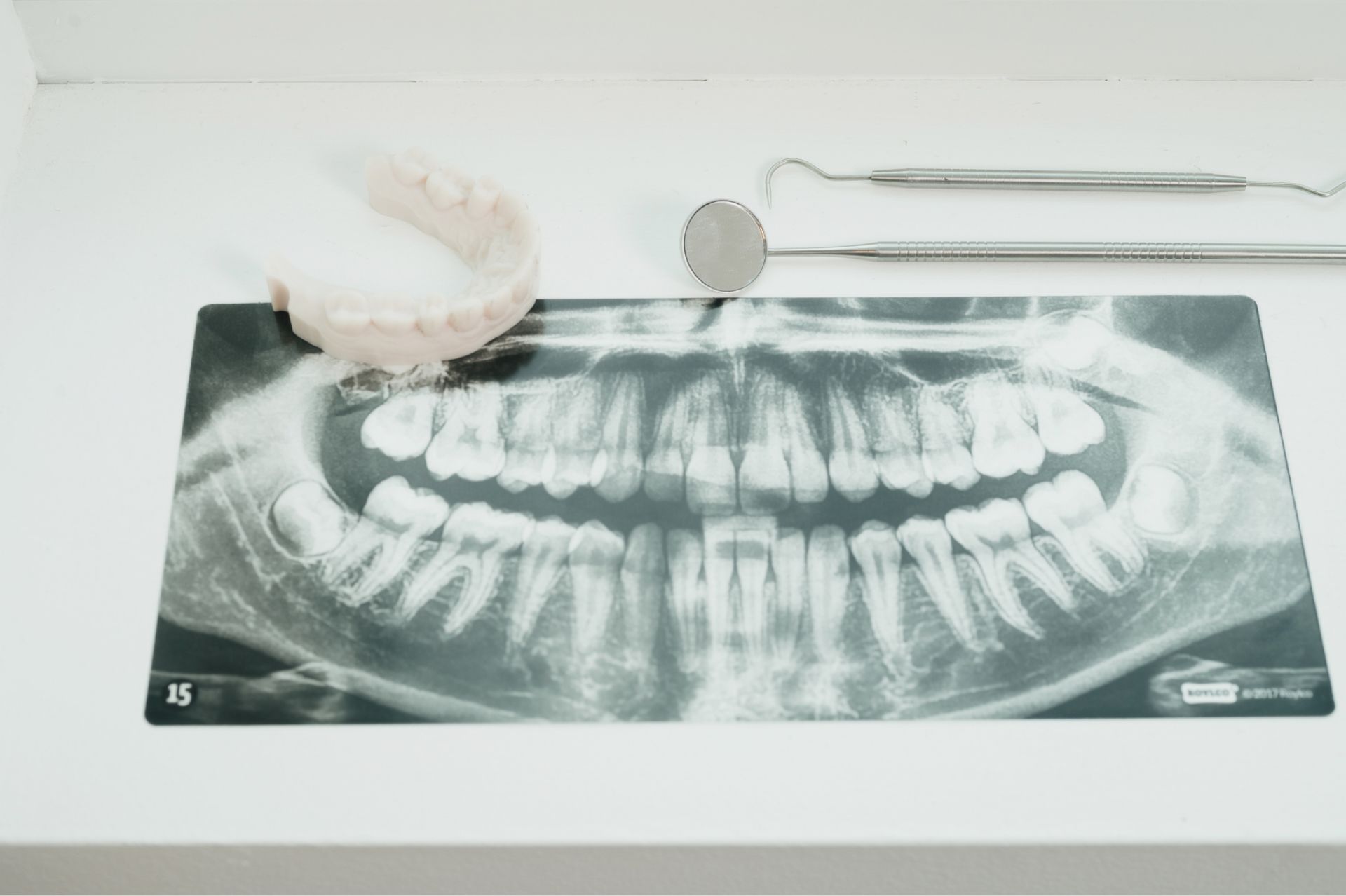 Smiling boy with braces sitting in a dental chair giving a thumbs up, with dental professionals wearing masks in the background.
