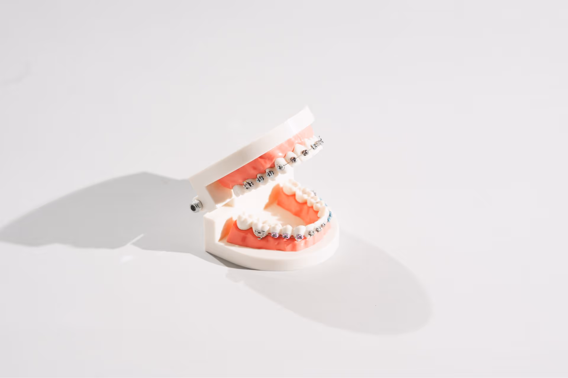 Young woman wearing a white sweater is holding a clear dental aligner near her mouth.