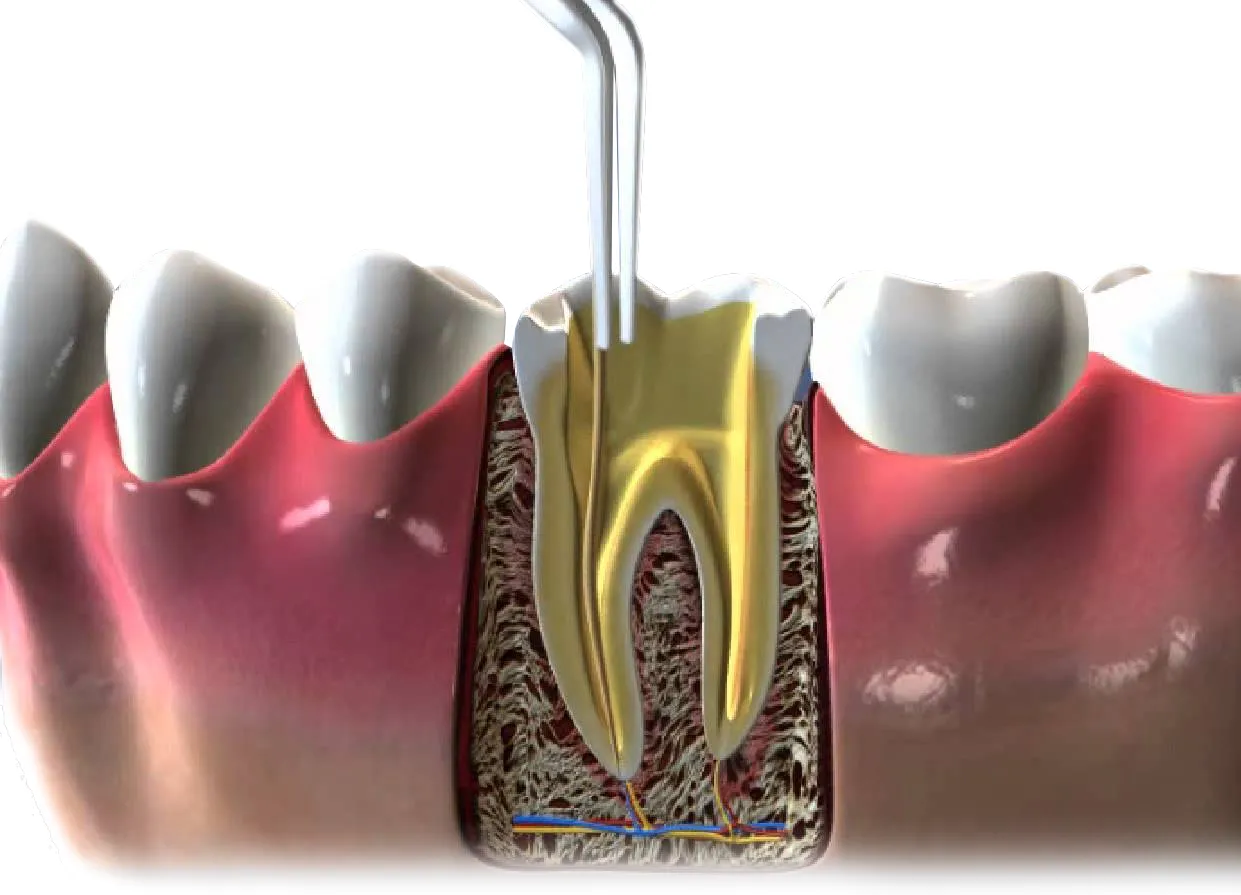 endodontiya