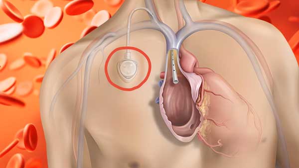 Bard video production by Anson Creative