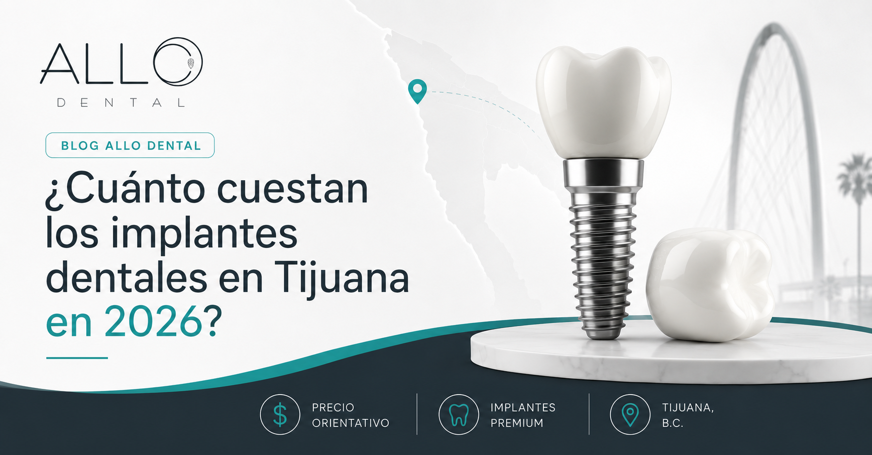 ¿Cuánto cuestan los implantes dentales en Tijuana en 2026?