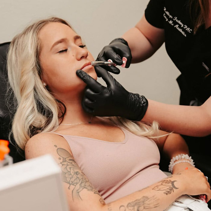 Lip filler treatment at Envy Me Aesthetics
