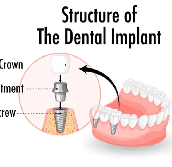 Smiling man sitting in a dental chair giving a thumbs-up in a bright dental office.