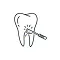 Illustration of a tooth with a dental drill applied to its surface.