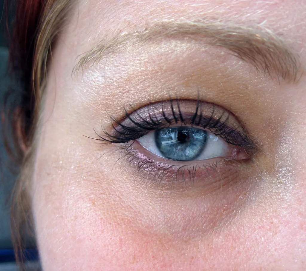 Under-eye rejuvenation