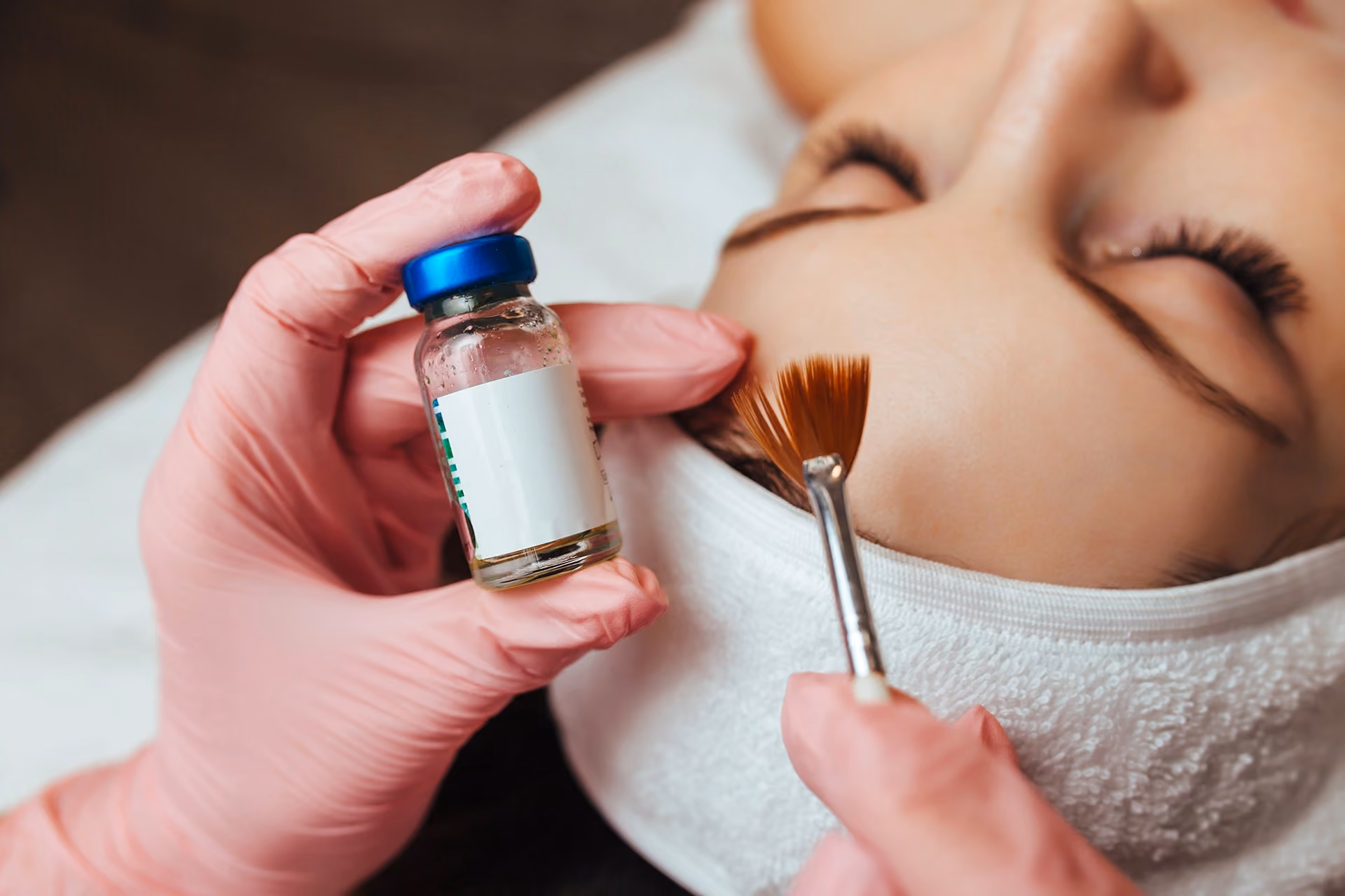 Professional peels