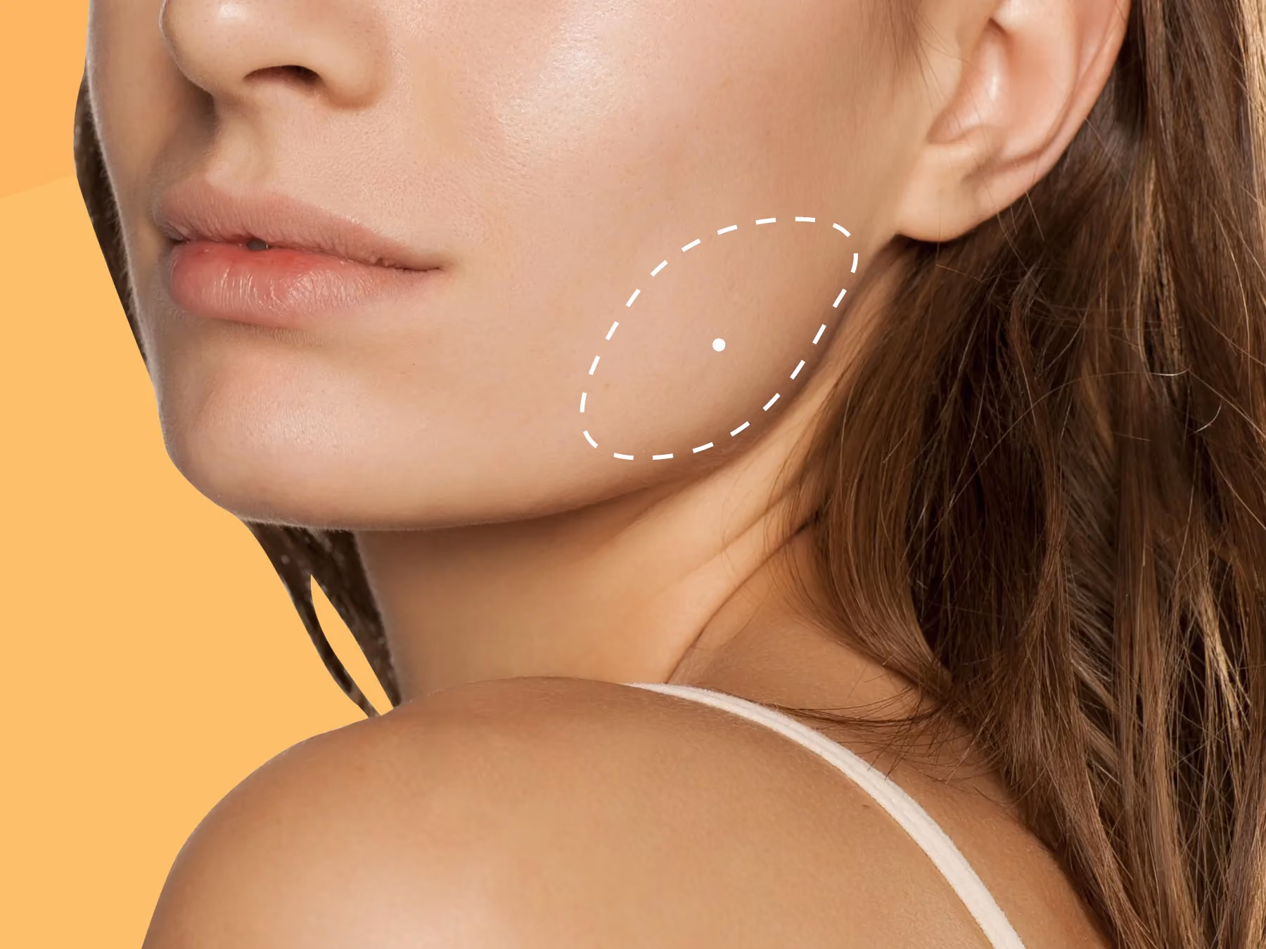 Masseter & TMJ Treatment
