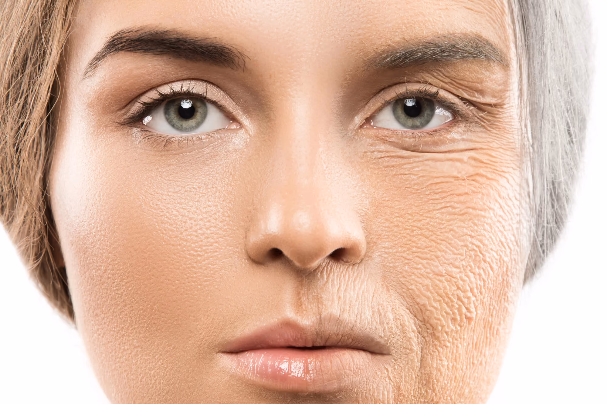 Fine Lines & Wrinkles