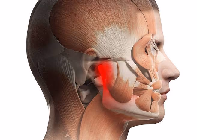 Jaw Tension, Teeth Grinding (TMJ)