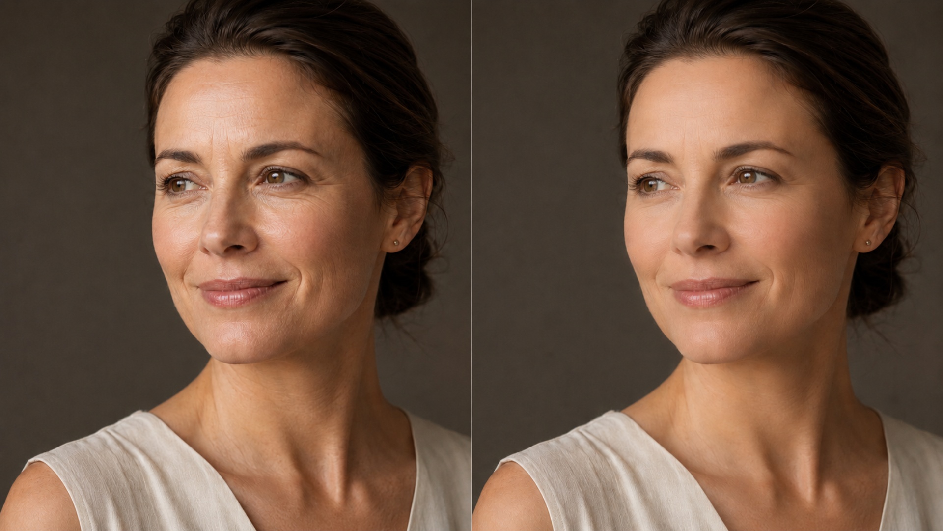 Fine Lines & Wrinkles