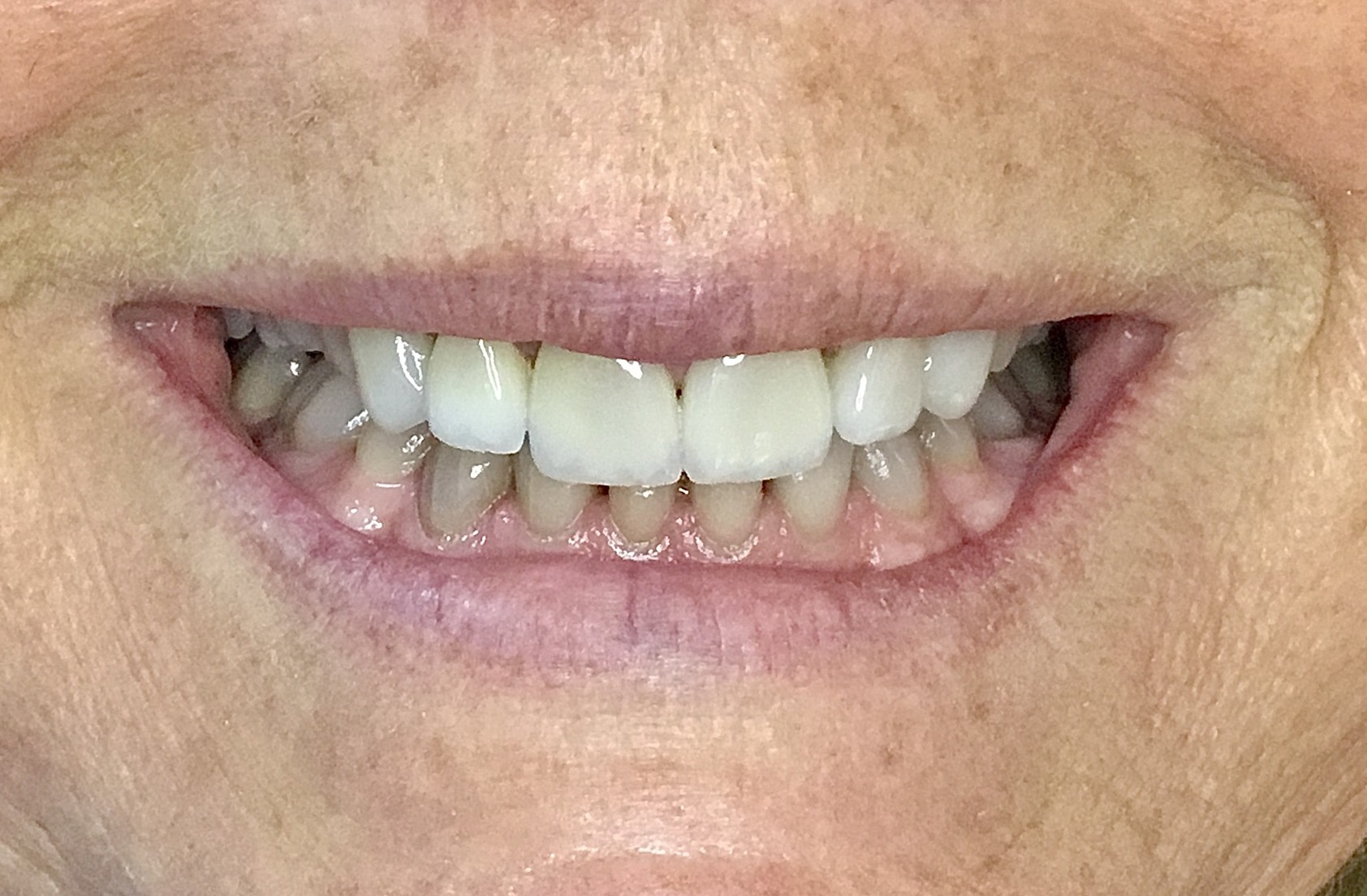 Before Image