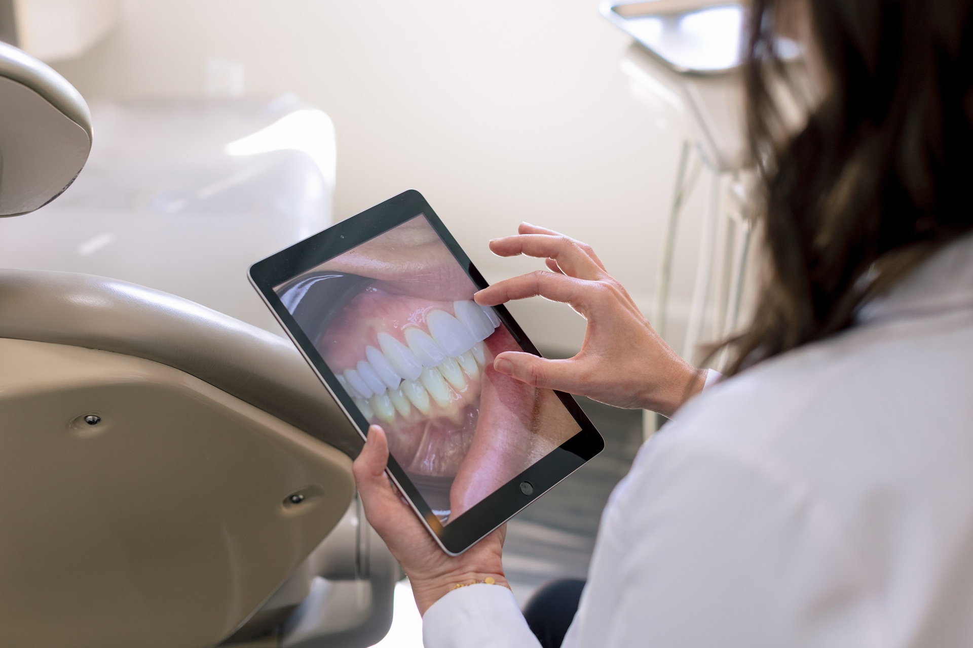 Veneers in Topeka