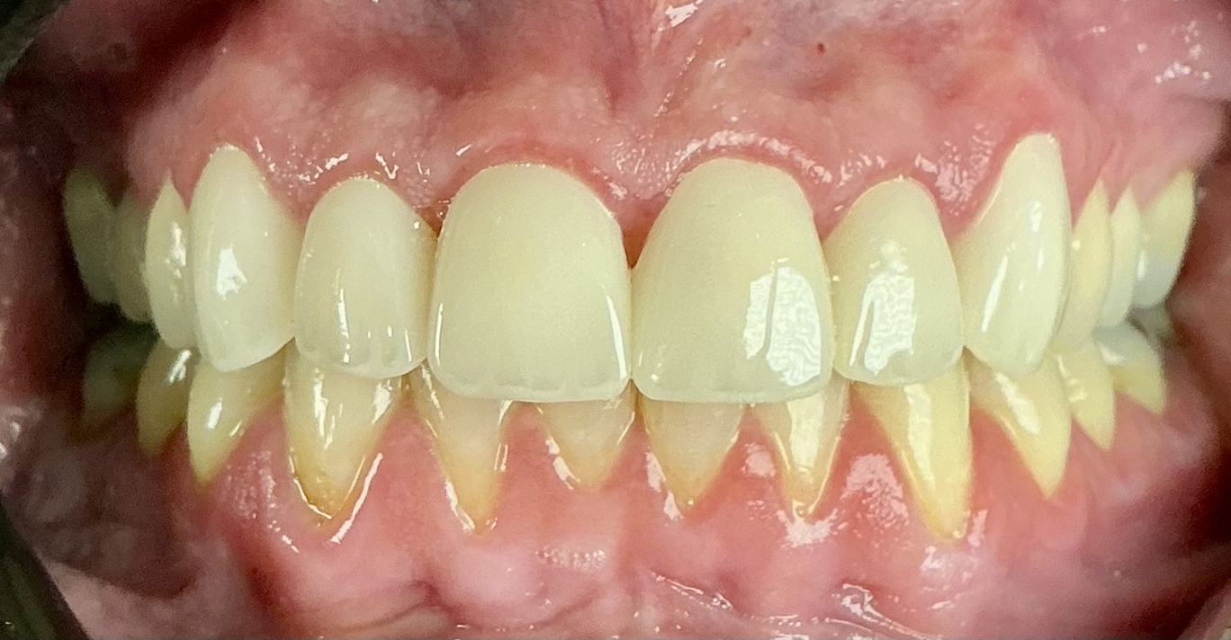 After Image